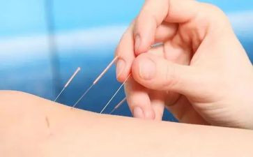 针灸医生工作总结8篇